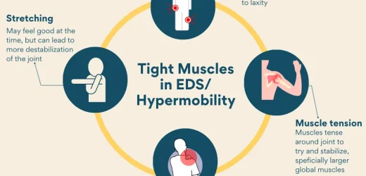 Adapting Traditional Strength Training for Hypermobile Individuals to Prevent Injury